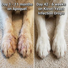 Kivori Yeast Infection Drops™ 4